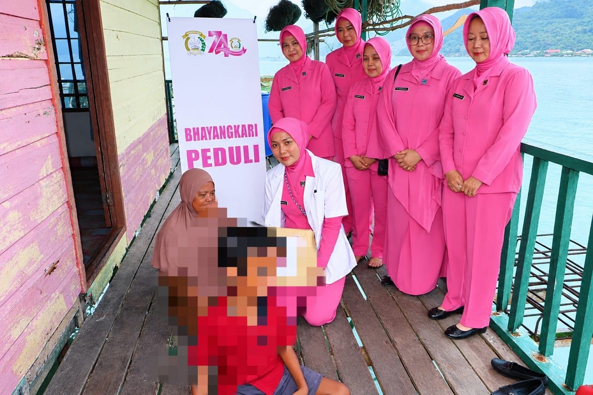 Bhayangkari Peduli, Sambangi Anak Penderita Hidrosefalus dan Lansia di Anambas
